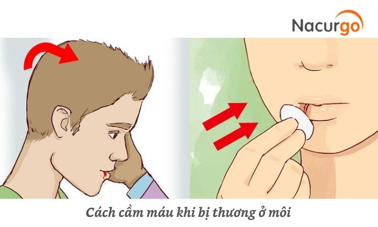 cam-mau-vet-thuong-o-moi