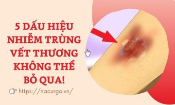 dau-hieu-nhiem-trung-vet-thuong