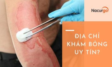địa chỉ khám bỏng uy tín