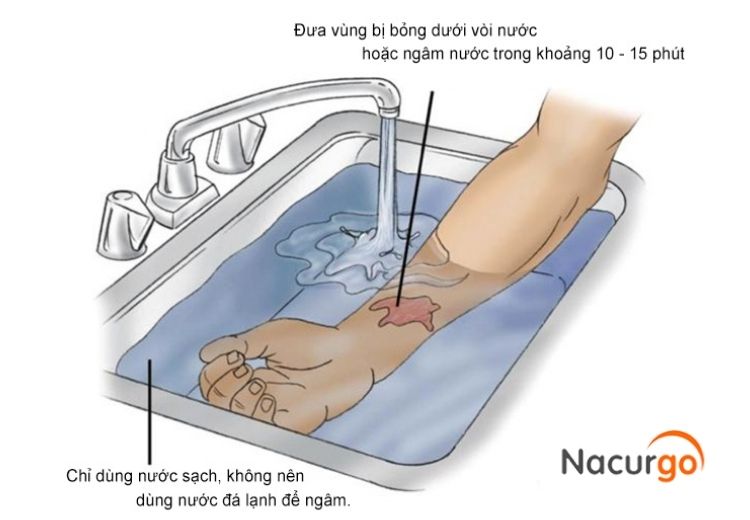 ngam-vet-bong-trong-nuoc