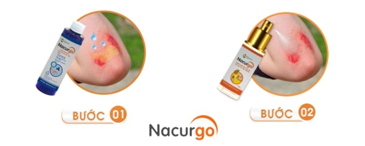 su-dung-bo-doi-nacurgo