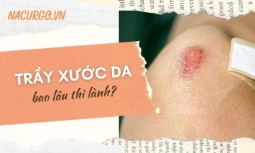 tray-xuoc-da-bao-lau-lanh