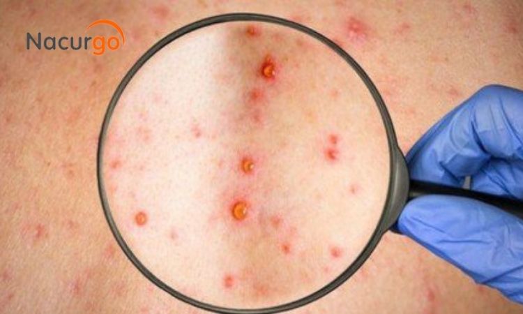 vet-thuong-do-virus