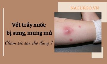 vet-tray-xuoc-bi-sung