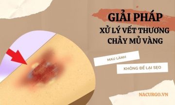 xu-ly-vet-thuong-chay-mu