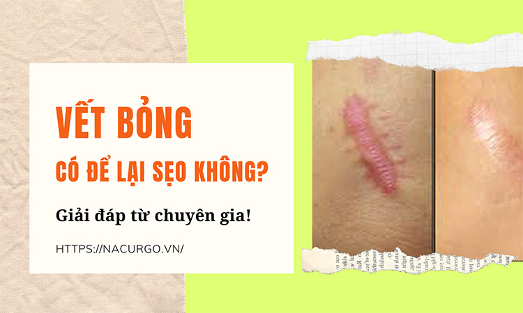 Bỏng có để lại sẹo không?