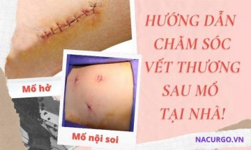 cham-soc-vet-thuong-sau-mo