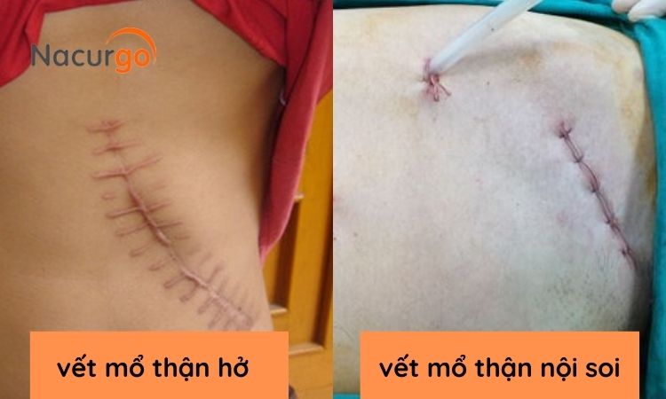 dac-diem-vet-mo-than