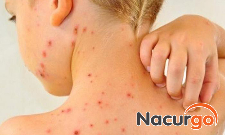 Trẻ từ 2 đến 7 tuổi nằm trong nhóm đối tượng dễ mắc bỏng dạ