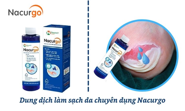 dung-dich-nacurgo-sat-khuan