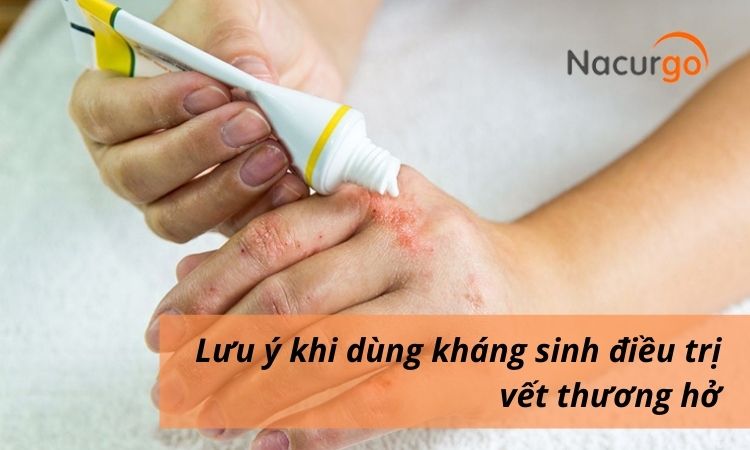 luu-y-khi-dung-khang-sinh