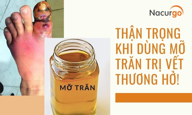mo-tran-gay-nhiem-trung