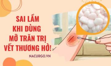 mo-tran-tri-vet-thuong-ho