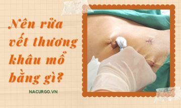 nen-rua-vet-thuong-bang-gi