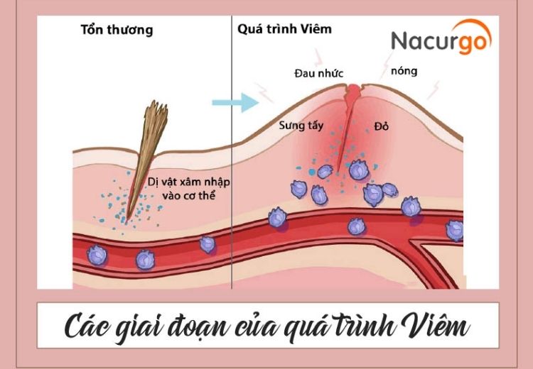 sung-tay-do-viem