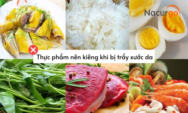 thuc-pham-nen-kieng-an