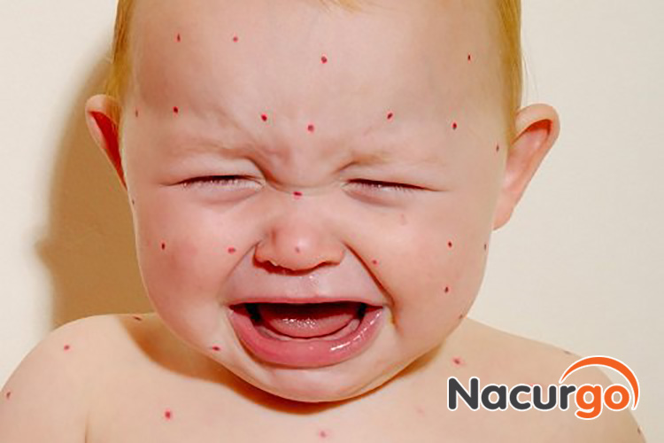 Khi bị bỏng dạ, trẻ sẽ rất khó chịu, quấy khóc nhiều