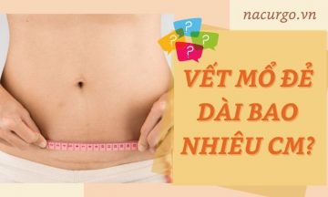 vet-mo-de-dai-bao-nhieu
