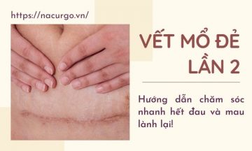 vet-mo-de-lan-2