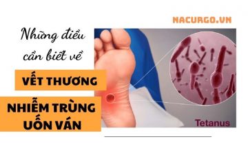 vet-thuong-nhiem-trung-uon-van