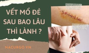 vet-thuong-sau-mo-de