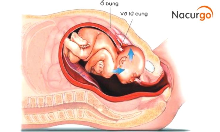 vo-nut-tu-cung