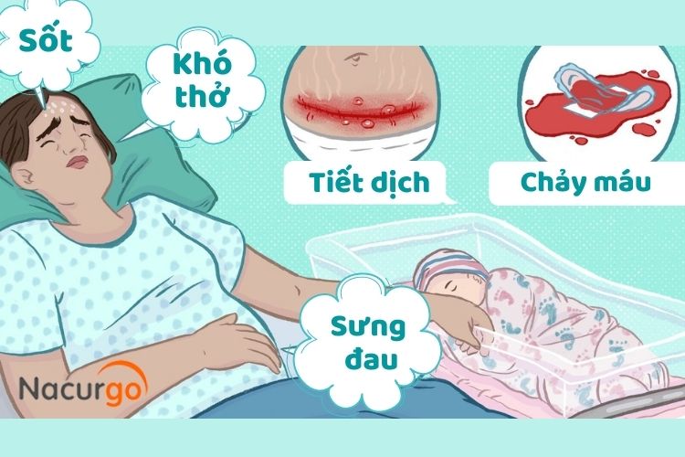 dau-hieu-vet-mo-de-ho