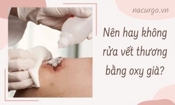 rua-vet-thuong-bang-oxy-gia