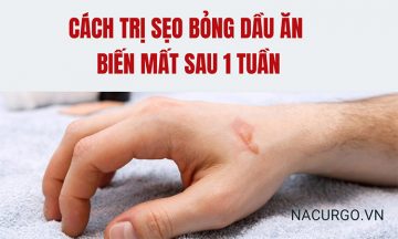 Trị sẹo bỏng dầu ăn biến mất sau 1 tuần