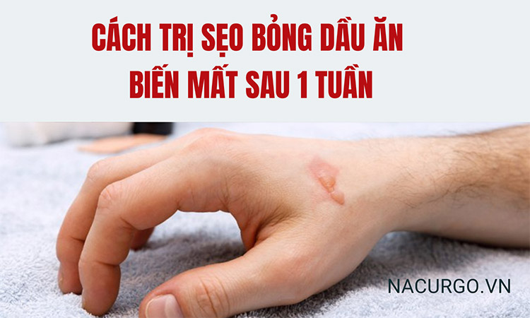 Trị sẹo bỏng dầu ăn biến mất sau 1 tuần