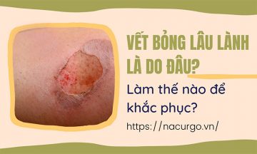 Vết bỏng lâu lành là do đâu?
