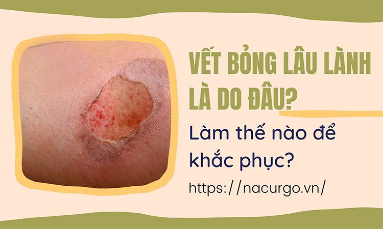Vết bỏng lâu lành là do đâu?