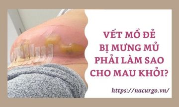vet-mo-de-co-mu