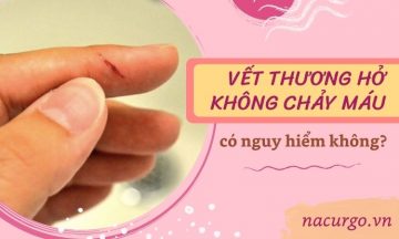vet-thuong-ho-khong-chay-mau
