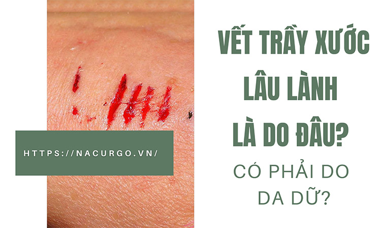 Vết trầy xước lâu lành do đâu?