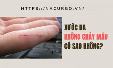 Vết xước da không chảy máu có đáng lo hay không?