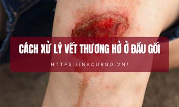Cách xử lý vết thương hở ở đầu gối
