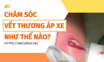 Chăm sóc vết thương áp xe như thế nào