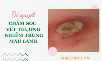 cham-soc-vet-thuong-nhiem-trung