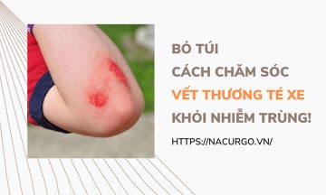 Chăm sóc vết thương té xe đúng cách