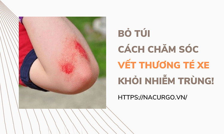 Chăm sóc vết thương té xe đúng cách