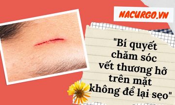 cham-soc-vet-thuong-tren-mat