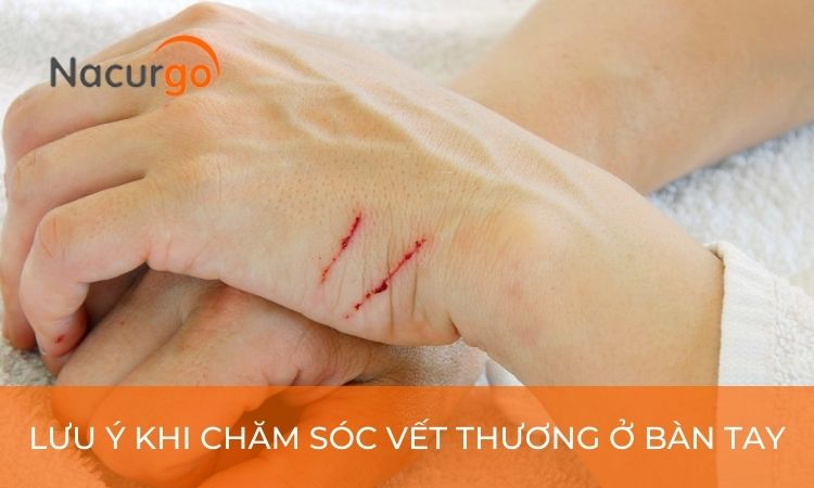 luu-y-vet-thuong-ban-tay