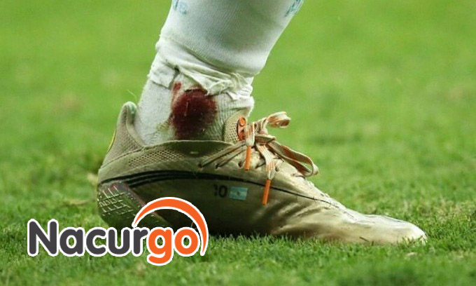Vết thương hở mắt cá chân có thể chảy máu nhiều