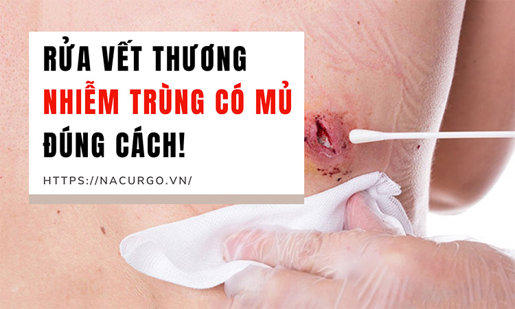 rửa vết thương nhiễm trùng có mủ đúng cách