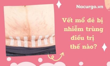 vet-mo-de-bi-nhiem-trung