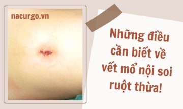 vet-mo-noi-soi-ruot-thua