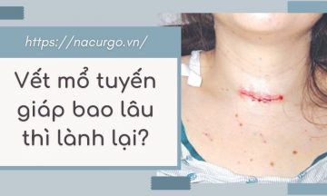 vet-mo-tuyen-giap