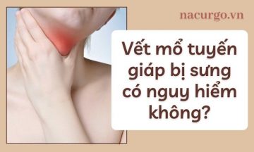 vet-mo-tuyen-giap-bi-sung