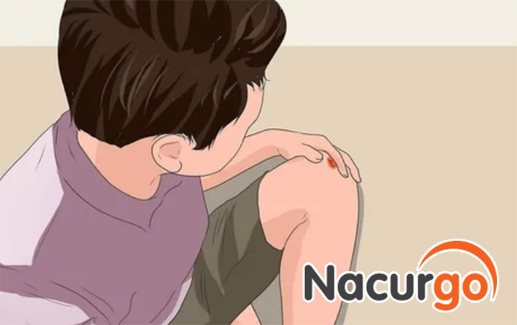 Vết thương hở ở đầu gối làdo đâu?